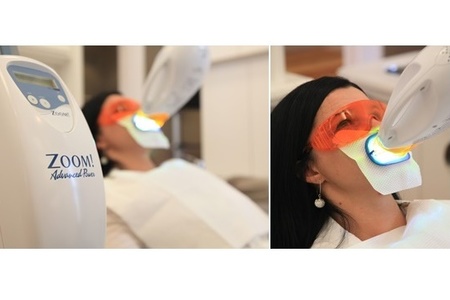 cost of zoom whitening cost of zoom whitening