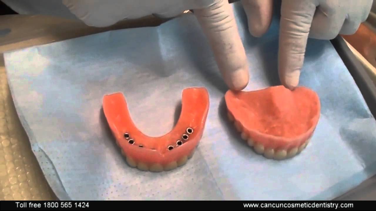 Snap In Dentures GloboMD