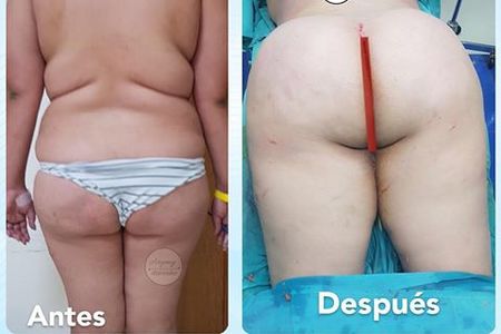 Dominican Women Ass Dominican Women Ass